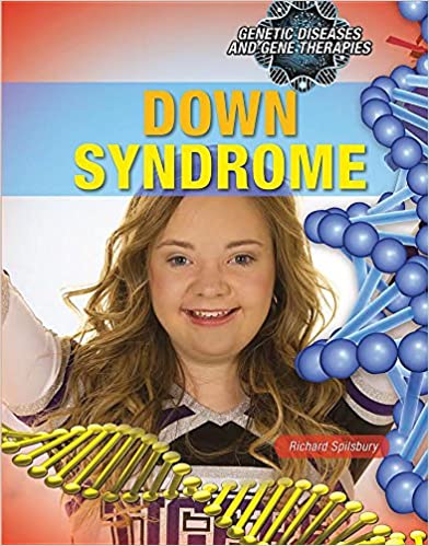Genetic Diseases and Gene Therapies: Down Syndrome
